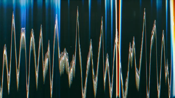 Sobreposição Distorção Ruído Falha Ecrã Angustiado Azul Laranja Cor Vibração — Fotografia de Stock