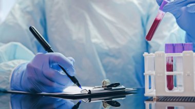 Kan örneği. Laboratuvar işi. Prezervatif takmış, eldiven takmış, serum tüplerini inceleyen ve test sonuçlarını panoya kaydeden hemşire..