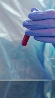 Dikey video. Kan sayımı tamamlandı. Teşhis testi. Mikrobiyoloji araştırması. Tıbbi koruyucu eldivenler giyen hemşire analiz tüpünü kabın içine koymayı inceliyor..
