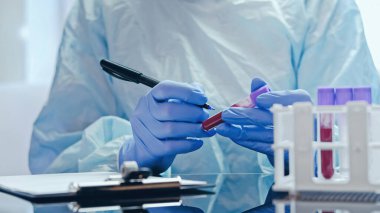 Laboratuvar teşhisi. Test sonuçları. Tıbbi koruyucu eldivenli teknisyen elleri masadaki tüplerdeki kan örneklerini pano notlarıyla işaretliyor..