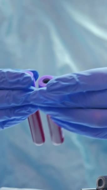 垂直录像 血液诊断 实验室分析 微生物学测试 手戴防护手套的医务工作者研究输入容器的样本管 — 图库视频影像