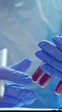 Dikey video. Kan testi. Klinik laboratuarı. Hemşire serum örnekleri üzerinde çalışıyor. Elleri tıbbi koruyucu eldiven, tüpleri ve kalemi var..