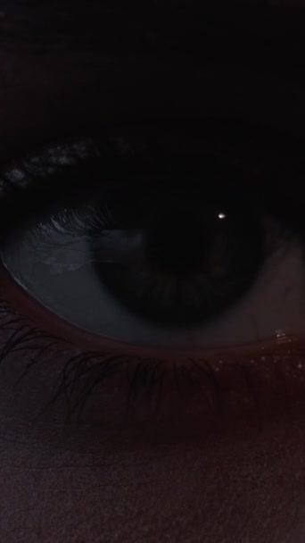 Pionowe Wideo Korekta Wzroku Chirurgia Laserowa Okulistyka Wzroku Makro Kobiety — Wideo stockowe