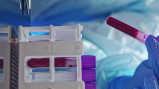 Verticale Video Bloedmonster Laboratoriumwerkzaamheden Verpleegster Beschermende Apparatuur Met Handen Rubberen — Stockvideo