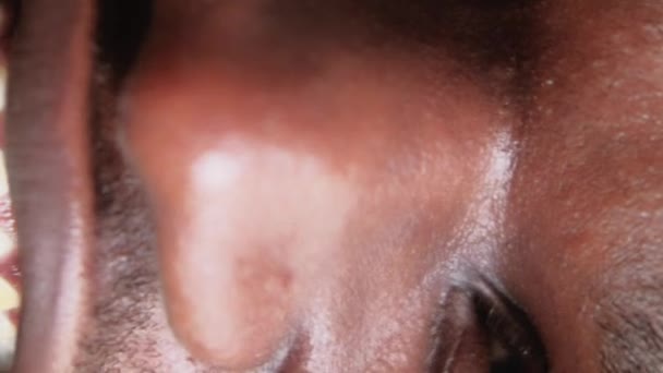 バーティカルビデオ 男性皮膚科 フェイスクレンジング アクネの処置 幸せな笑顔の男の目鼻の頬領域完璧な完璧な無線顔の肌 — ストック動画