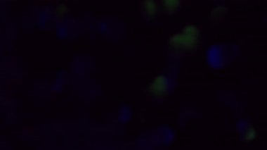 Bokeh tatili. Parıltı kıvılcımları. Renkli sarı kırmızı mor yanıp sönen lensler soyut bulanık ışık arka planında yanıp sönüyor..