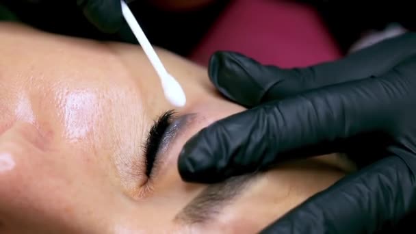 Rubbing Tattoo Removal Compound Surface Traumatized Eyelid Removing Old Permanent — Stock Video