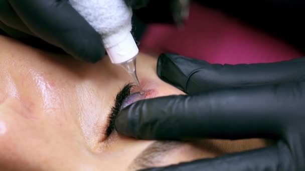 Procedura Rimozione Del Tatuaggio Con Una Macchina Del Tatuaggio Rimozione — Video Stock