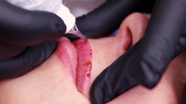 Usta, dudaklarına dövme çıkarıcı sürmek için modelin dudaklarını parmaklarıyla gerer. Yüksek kaliteli FullHD görüntüler