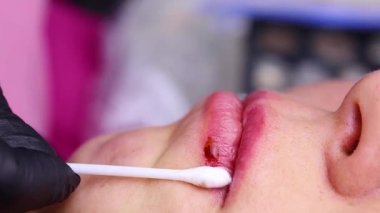 Pamuklu çubukla, usta dudak dövmesini çıkardıktan sonra aşırı oksitlenmiş pigmenti çıkarır. Yüksek kaliteli FullHD görüntüler