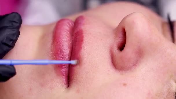 Verdeling Van Zuurverwijderaar Het Oppervlak Van Lippen Met Een Borstel — Stockvideo