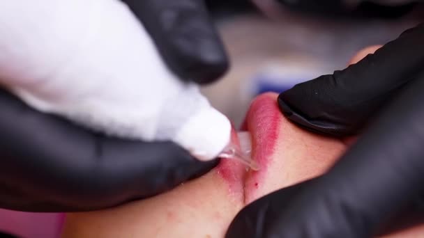 Rimuovere Vecchio Trucco Permanente Dalle Labbra Con Una Macchina Tatuaggi — Video Stock