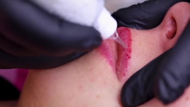 入れ墨を溶解化合物の皮膚への導入のための唇のマイクロ穿刺 高品質のフルHd映像 — ストック動画
