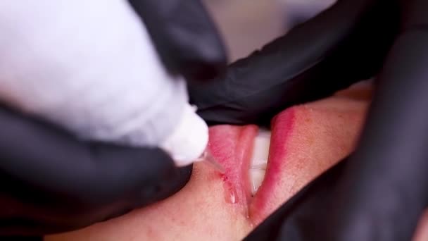 Close Introdução Drogas Que Dissolvem Tatuagem Usando Piercings Labial Imagens — Vídeo de Stock