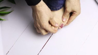 Ayak parmağında nasır olan ayak.