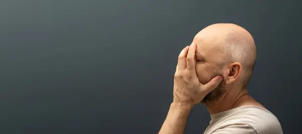 Trauriger Mann Mit Kopfschmerzen Oder Migräne Gestresster Typ Mit Schmerzhaftem — Stockfoto