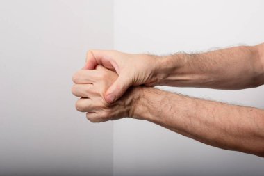 Elini kaşıyan orta yaşlı bir adam. Deri hastalığı. Alerjik reaksiyon. Dermatolojik bakım