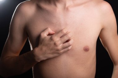 Kızgın bir adamın göğsü. Elin kaşınıyor. Deri hastalığı. Kızarıklık, alerji. Siyah arkaplanda izole.