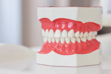 Diş laboratuarında modern takma diş modeli