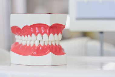 Diş laboratuarında modern takma diş modeli