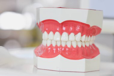Diş laboratuarında modern takma diş modeli