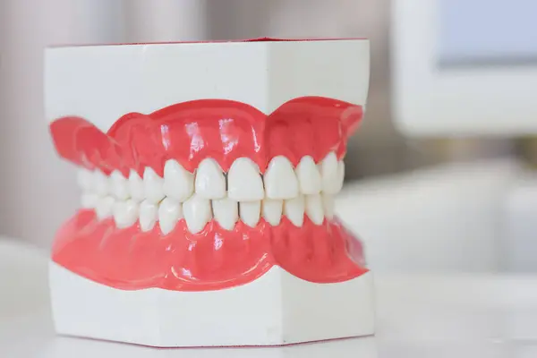 Diş laboratuarında modern takma diş modeli