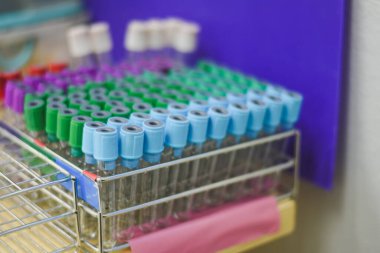 Kan toplama tüpler Laboratuvarı