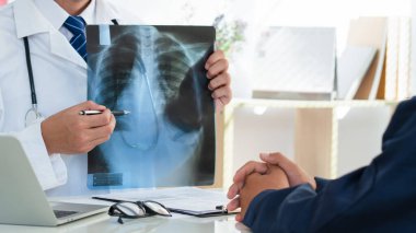 Hastanedeki hastanın göğüs röntgeni film ciğerlerini inceleyen doktor. Akciğer sorunu. Akciğer kanseri ya da zatürree konsepti. Boşluğu kopyala.