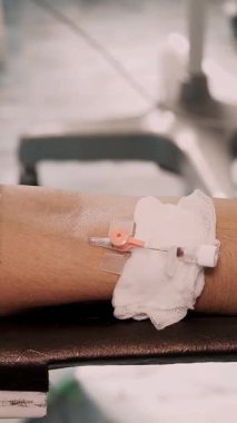 Yakın plan. Periferik venöz kateter ameliyata alındı. İlaç. Hastanede ameliyat ve canlandırma. covid-19 salgını