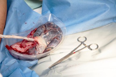 Doğumdan sonra insan plasentası