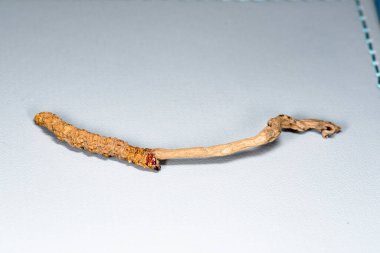 Çin mantarı paraziti Cordyceps yarsagumba