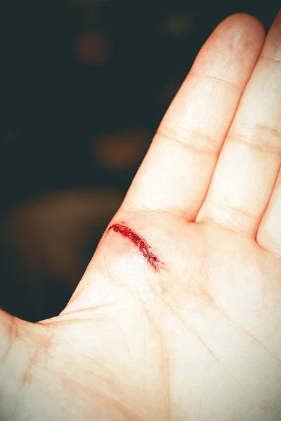 Man Hand Sharp Cut Knife Wound — Stock Photo, Image