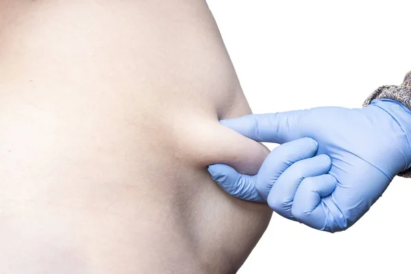 Weiblicher Bauch Von Einem Arzt Mit Blauem Gummihandschuh Eingeklemmt Vor — Stockfoto