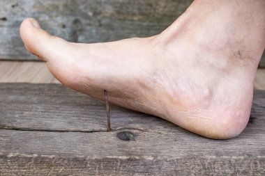 Çırılçıplak ayak, yıpranmış tahta bir çivinin keskin bir çivisine basıyor, yumuşak odaklı. 