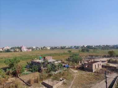 Üst ve orta rektus kasları, kornea, iris, göz küresi, lens ve arka planda bulanıklık olan insan gözü modeli.