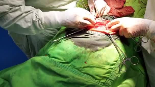 Calcutta Västbengalen Indien Juli 2023 Två Kirurger Bär Handskar Förkläden — Stockvideo