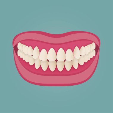Human teeth malocclusion set with realistic images of mouth jaws with crooked teeth and text captions. Normal and abnormal occlusion. Vector illustration