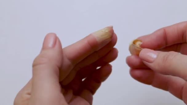 Ferida Dedo Mão Depois Penso Rápido Primeiros Socorros Para Lesões — Vídeo de Stock