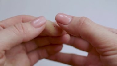 Womans hand with an injured finger. Lacerated knife wound after treatment with adhesive tape. Injuries while cooking. Close-up.