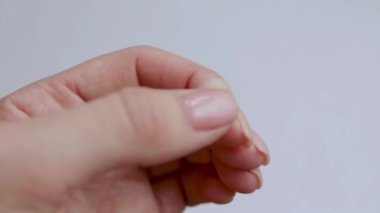 Womans hand with an injured finger. Ragged knife wound. Injury while cooking. Close-up.