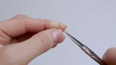 Yaranın yırtık kenarlarını makasla çıkar. Yakın plan. Yaralar için ilk yardım. İzole edilmiş arka plan. Video.