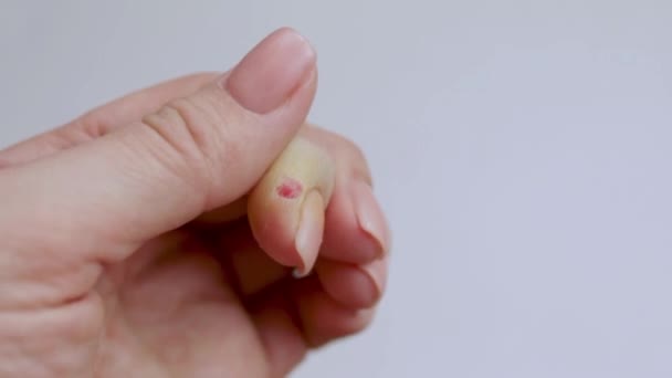 Wound Index Finger Band Aid Close First Aid Injuries Isolated — Vídeo de Stock