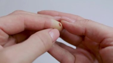 Lacerated knife wound after treatment with adhesive tape. Womans hand with an injured finger. Close-up. The concept of injury and wound treatment. Video.