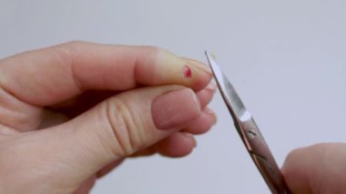 Remove the torn edges of the wound with scissors. Close-up hands. Help with injuries. Isolated background. Video.
