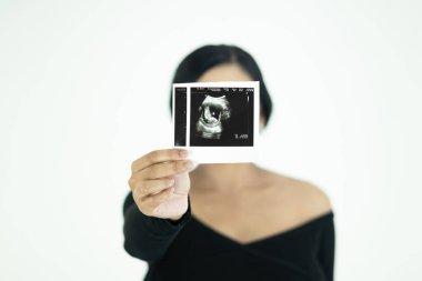 Genç bir kadın bebeğinin ultrason görüntüsünü gösterir. Ultrason görüntüsüne odaklanır.