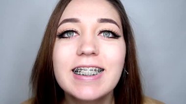 Gülümseyen ve diş telleri gösteren genç bir kadın, kamerada düzeltici elastik. Yakın plan: muhteşem bayan diş macununu düzeltmek için diş teli ve elastik takar ve mükemmel gülümseme için elastik takar.