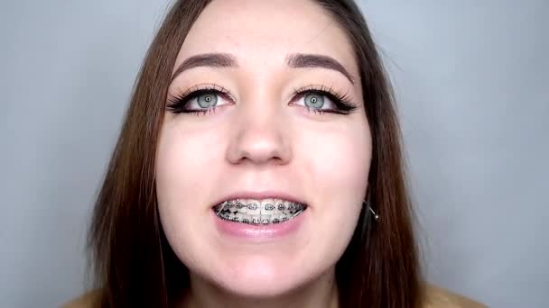 Νεαρή Γυναίκα Χαμογελάει Και Δείχνει Σιδεράκια Διορθωτικά Ελαστικά Στην Κάμερα — Αρχείο Βίντεο