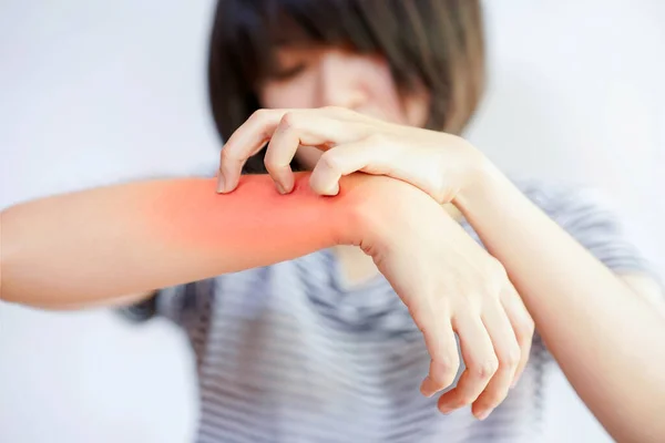 Itching (Pruritus) is a common skin condition that often leads to scratching.