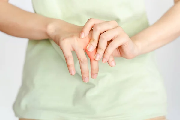 Kobieta Dotyka Swoich Kostek Powodu Urazu Lub Reumatoidalnego Zapalenia Stawów — Zdjęcie stockowe