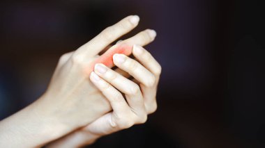 Eklem ağrısı olan ellere yakın çekim. Kişi, eklemlerinde rahatsızlık, ağrı ya da eklem iltihabı olduğunu belirterek elini tutuyor..